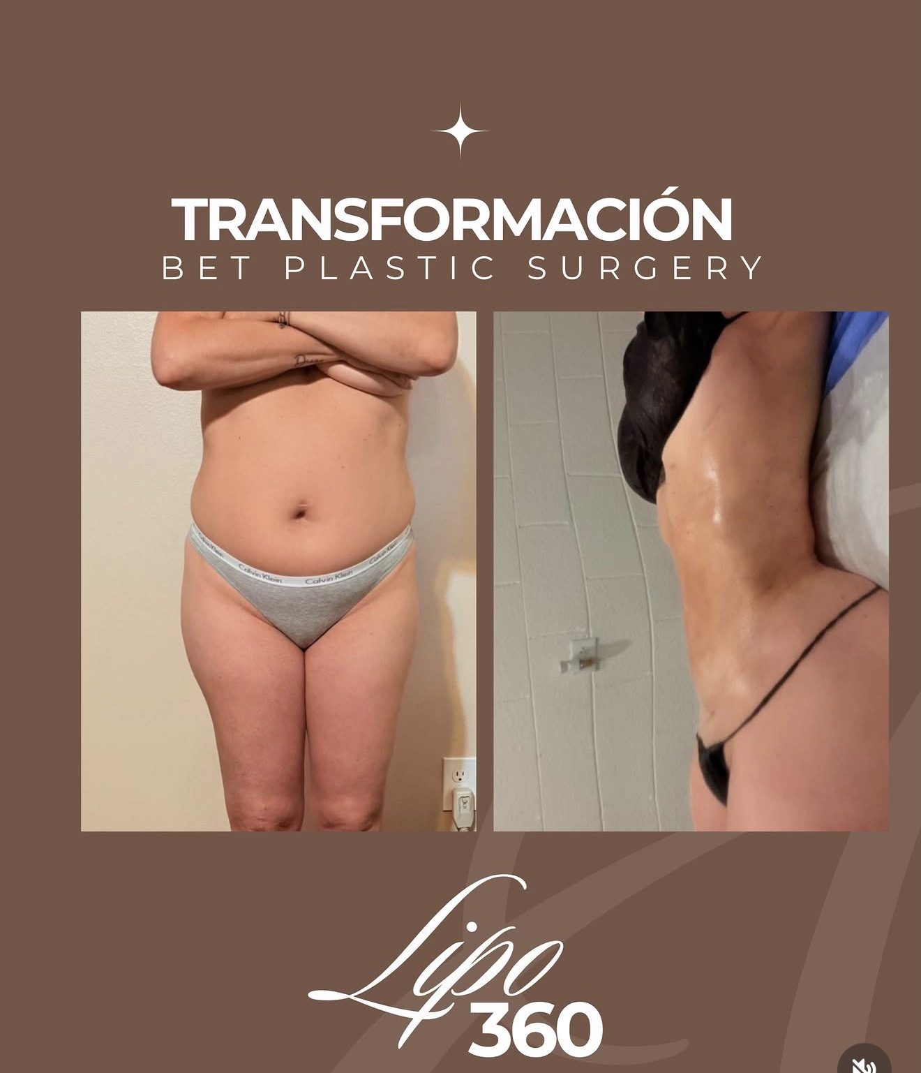 Resultado real de paciente de Dr. Mel Ortega en BET Aesthetics Center