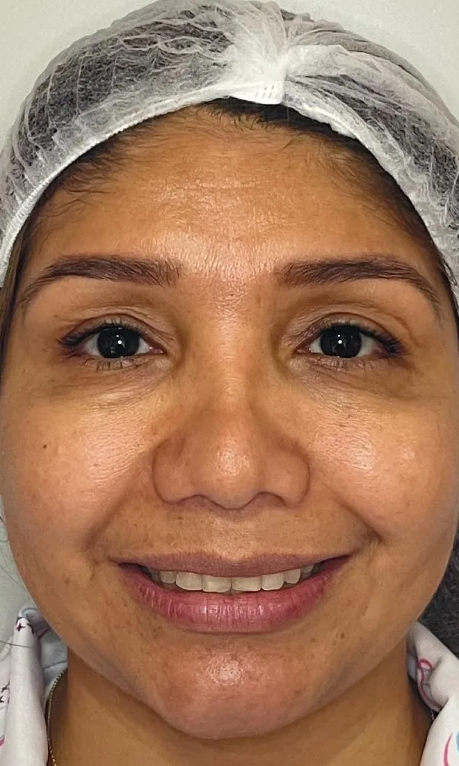 Antes: paciente antes del tratamiento estético
